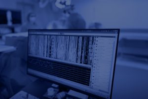 A close-up of a computer screen displays real-time neural monitoring data during surgery, with blurred medical staff in the background.