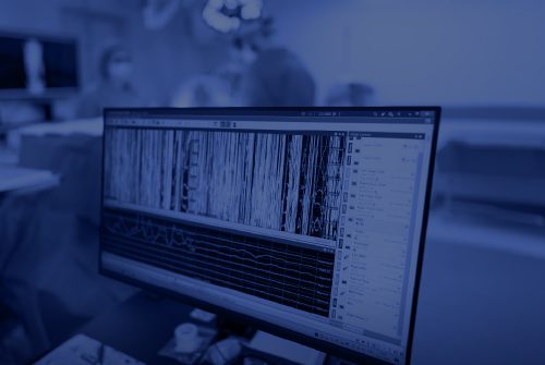 A close-up of a computer screen displays real-time neural monitoring data during surgery, with blurred medical staff in the background.